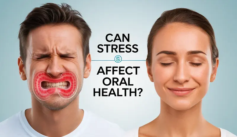 Can Stress Affect Oral Health (Expert's Guide)