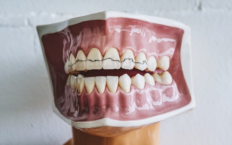 Can Medications Cause Gum Problems