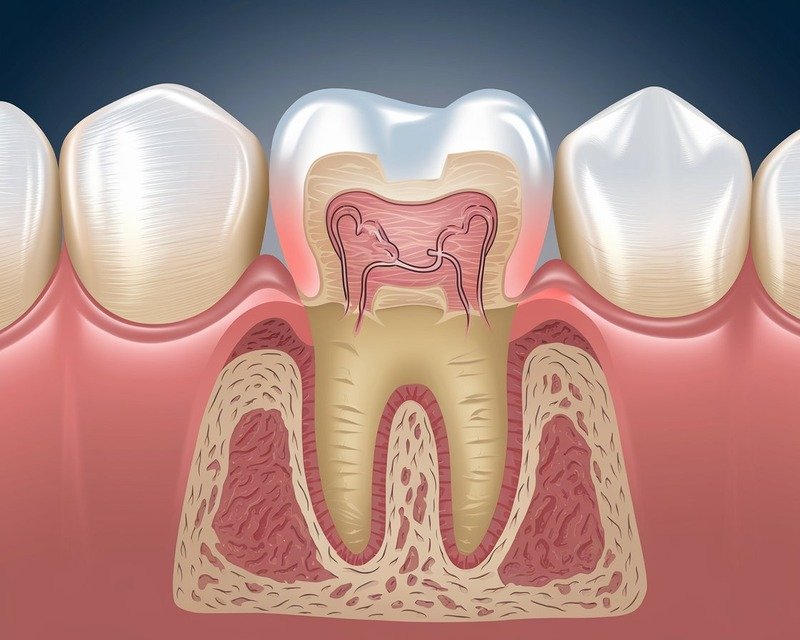 What Causes Tooth Crown Sensitivity